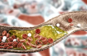 نتائج مذهلة خلال 30 يوما.. نظام غذائي يخفض الكوليسترول كما تفعل الأدوية